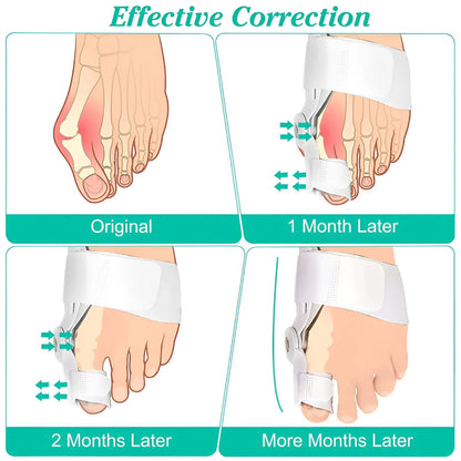 Bunion Splint and Big Toe Straightener – Orthopedic Hallux